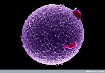 B0002101 Human egg with coronal cells/purple/alone