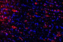 Um modelo primata para a Doença de Alzheimer